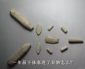 一年前下体塞进了异物怎么？