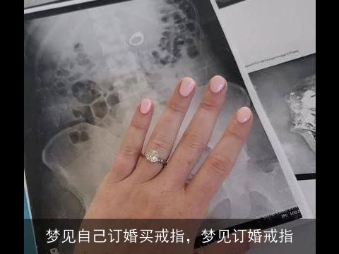 梦见自己订婚买戒指，梦见订婚戒指